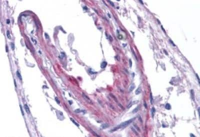 Immunohistochemistry-Paraffin: APJ/Apelin receptor Antibody [NBP3-14541]